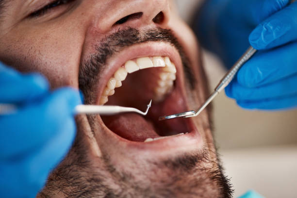 Best Weekend Emergency Dentist in Easton, PA